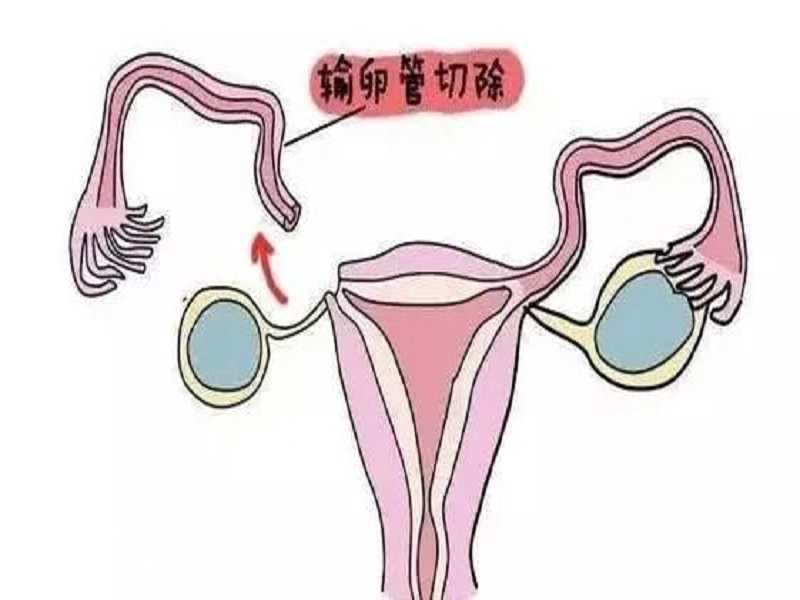 广州供卵认可坤和助孕,广州供卵医院订 坤和助孕