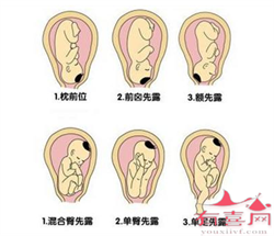 广州最大供卵中介~广州如何借卵生子~广州借卵试管代生孩子，单身女性不允许