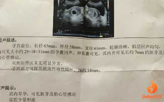 香港供卵机构有哪几家,【广州有几家供卵机构】第一个月就中，希望宝宝平安