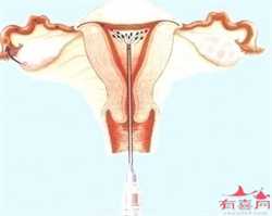 广州供卵代孕怎么样，广东广州试管二代成功率哪家好？
