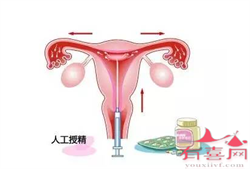 广州助孕供卵多少钱，2022试管助孕攻略：广州试管多少钱一次？