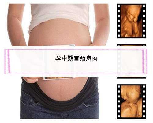 孕中期宫颈息肉